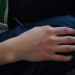 Seeking Help From an Acupuncturist in Portland