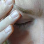 acupuncture for headaches provides relief