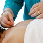 what does acupuncture needles feel like