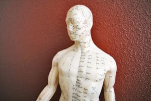 What is Acupuncture